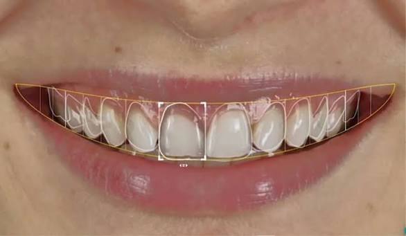 Digital Smile Design